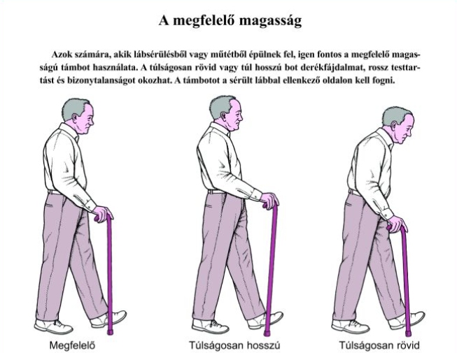 A megfelelő magasság – bot és mankó használata